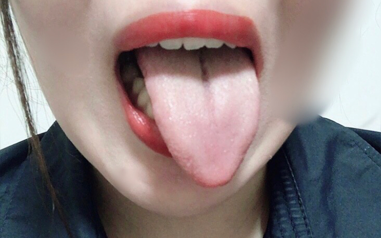 あ