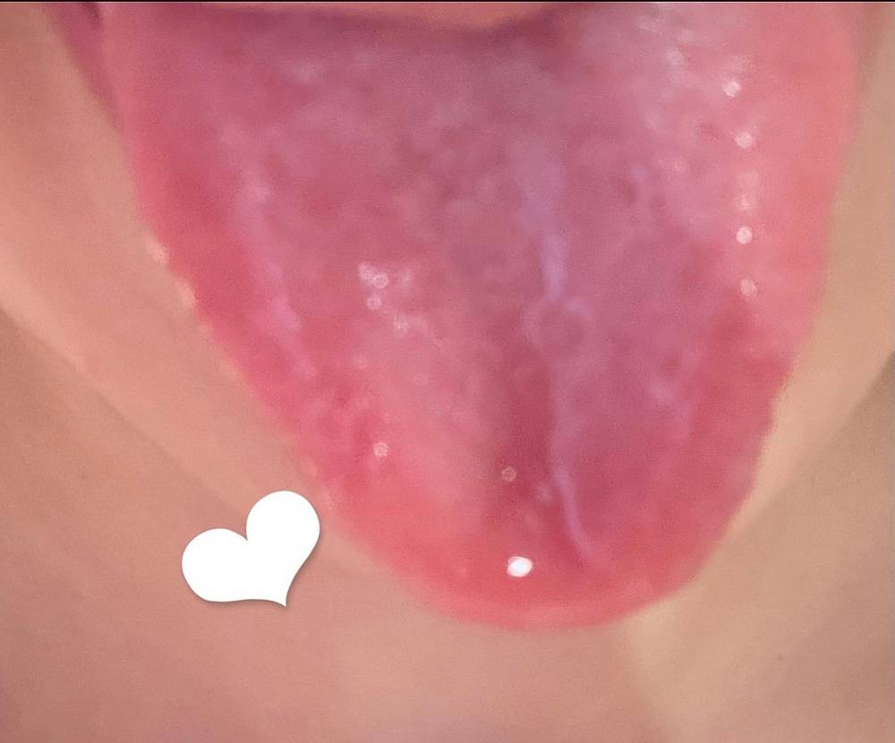 マ